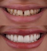 cosmetic-denistry-768x768