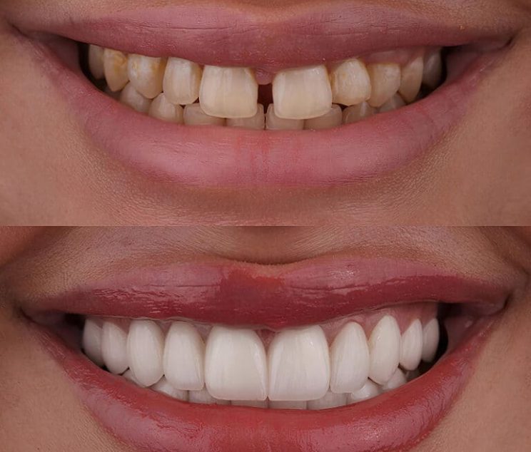 cosmetic-denistry-768x768