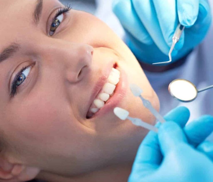 young-woman-selecting-tooth-colour-e1513773831918